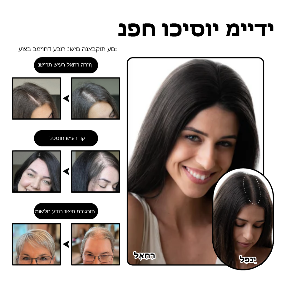 ClipCrown | טופר שיער קליפס טבעי